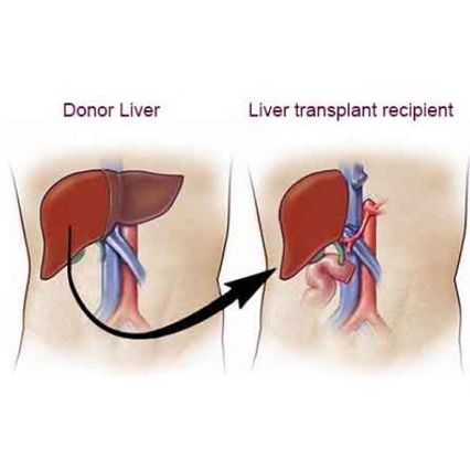 Liver transplant pune